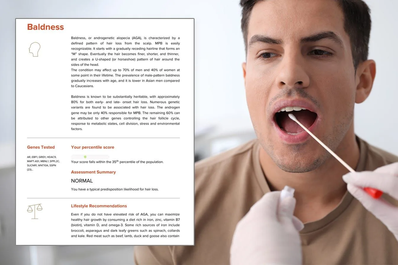 A man having his cheek swabbed beside a DNA report page on baldness